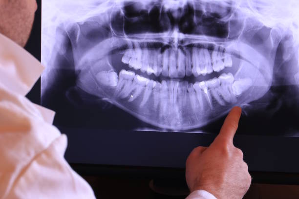 Best Emergency Treatment for Toothache in Verona, WI